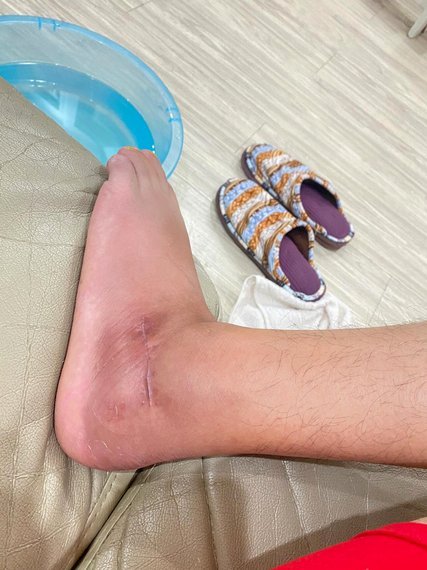 盖伊左脚跟腱断裂申花迎重击