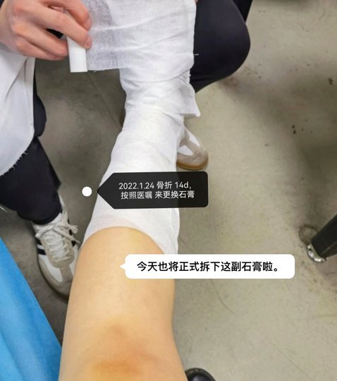 申花公布盖伊伤情：左脚跟腱断裂